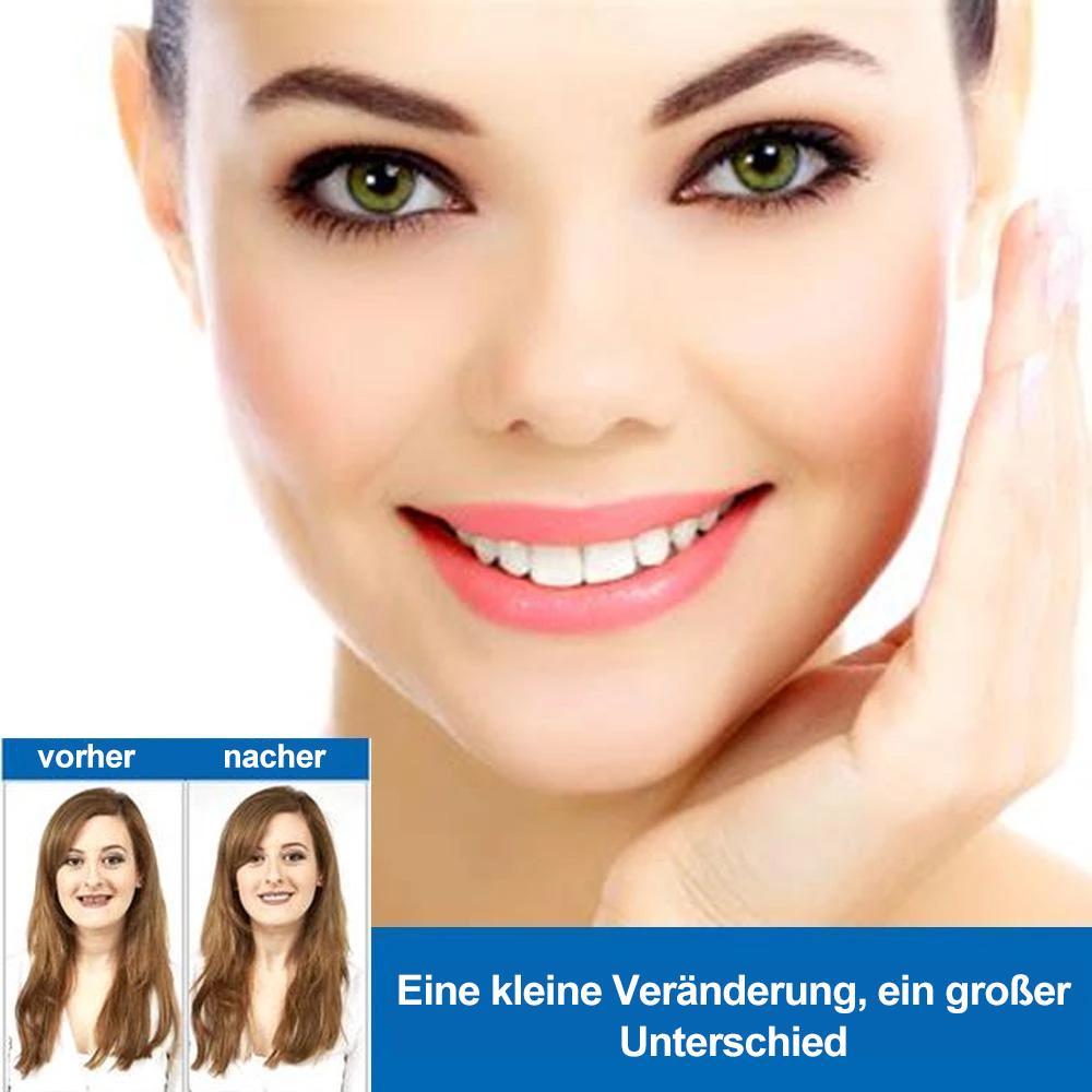 1 SET DIAMOND SMILE VENEERS (OBEN & UNTEN ZÄHNE)