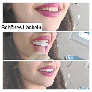 1 SET DIAMOND SMILE VENEERS (OBEN & UNTEN ZÄHNE)