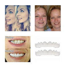 Laden Sie das Bild in den Galerie-Viewer, 1 SET DIAMOND SMILE VENEERS (OBEN &amp; UNTEN ZÄHNE)
