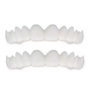 1 SET DIAMOND SMILE VENEERS (OBEN & UNTEN ZÄHNE)